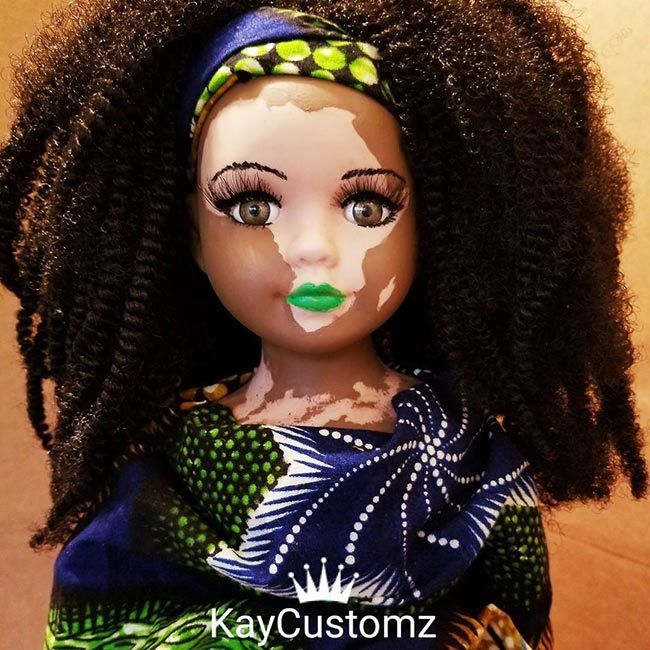 vitiligo doll vitligo doll