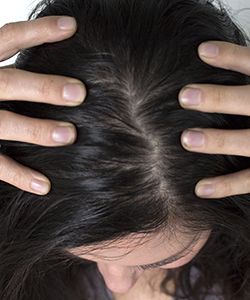 7 Types of Scalp Disorders, and How to Tell if You Have One