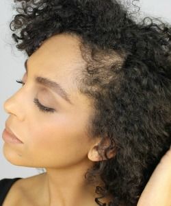 2 Easy Hacks For Hiding Your Traction Alopecia