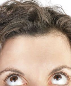 The New Plastic Surgery that Women Are Getting on their Hairlines