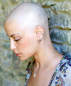 6 Little Known (But Common) Causes of Alopecia