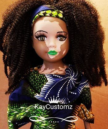 I Am a Full Grown Woman Who Loves Vitiligo Dolls