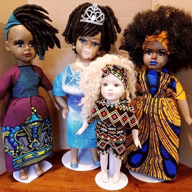 vitiligo dolls in a group