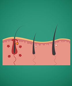 Trichology: Study of the Hair and Scalp