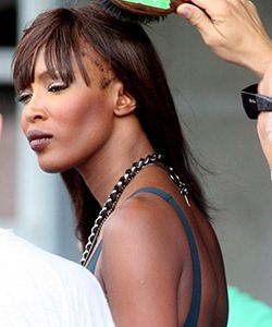 Top 8 Temple & Nape Treatments for Thinning Edges