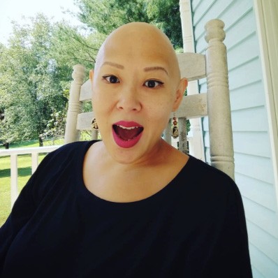 HairLoss700x700